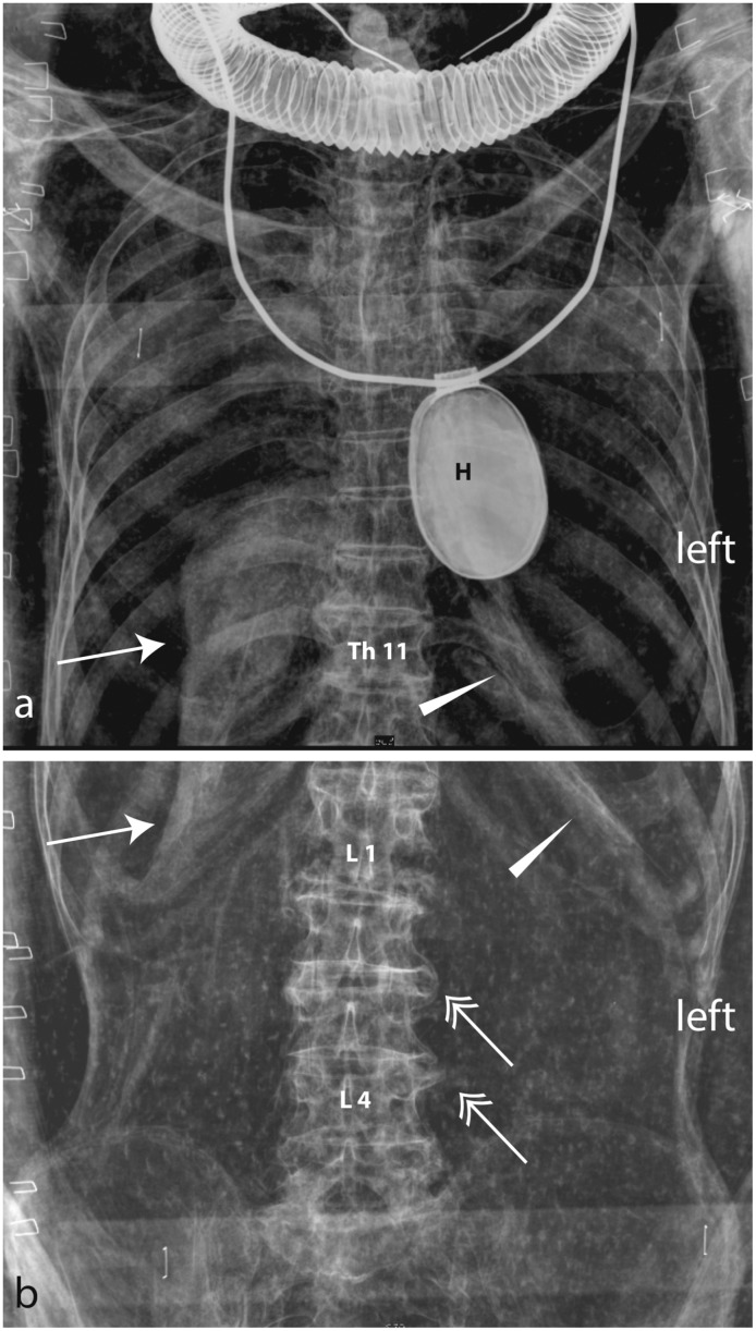 Fig 5