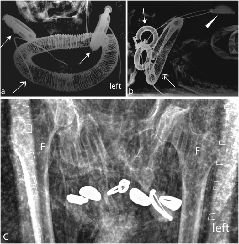 Fig 3