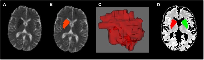 Fig 1