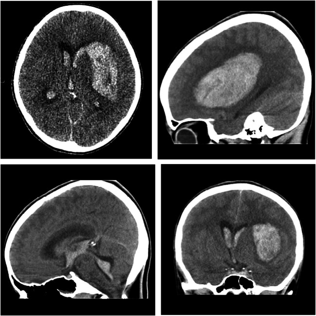 Fig. 1