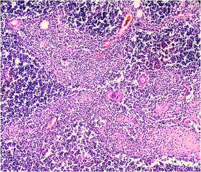 Fig. 4