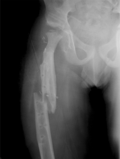 Fig. 6