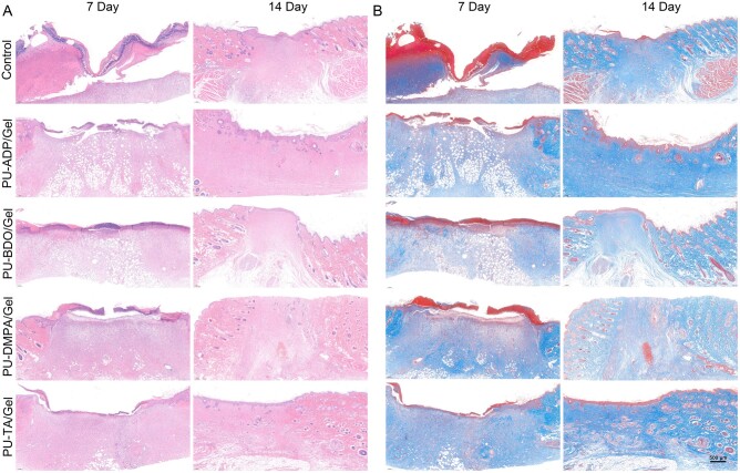 On The Development Of Modular Polyurethane Based Bioelastomers For Rapid Hemostasis And Wound