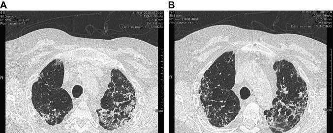 Fig. 4