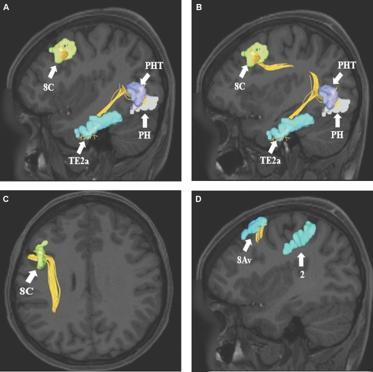 FIGURE 11.