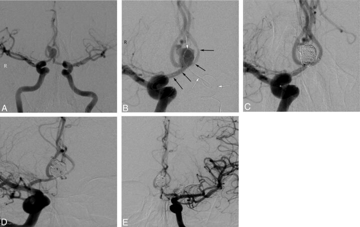 Fig 4.