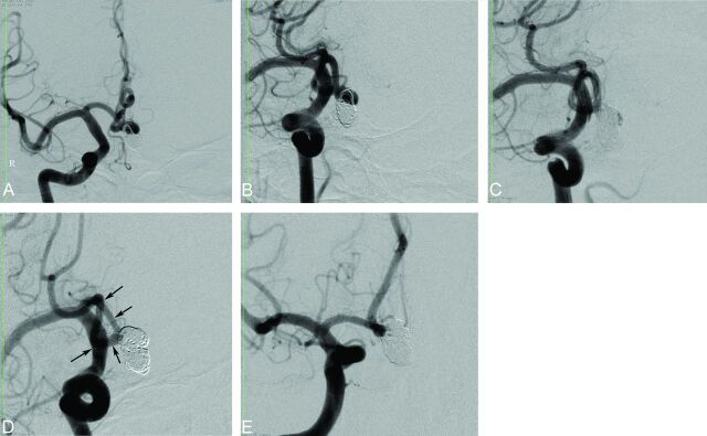 Fig 5.