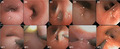 graphic file with name CCR3-8-1765-g002.jpg