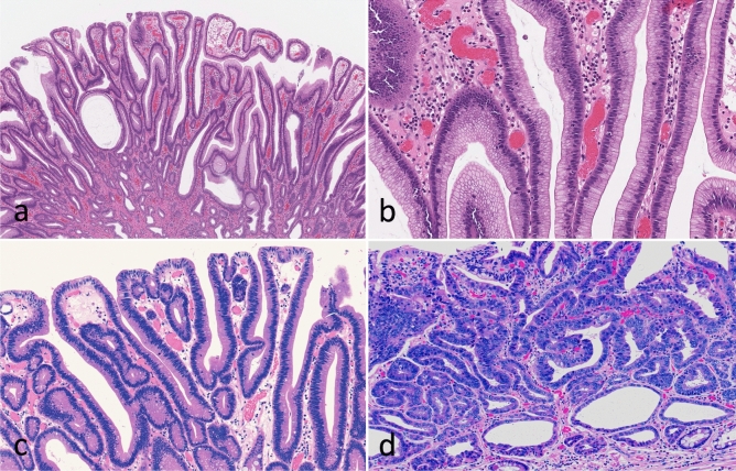 Fig.1