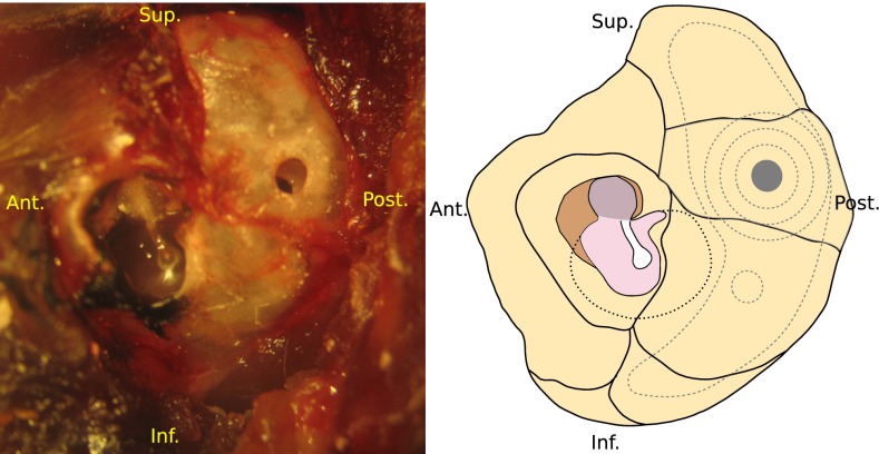 FIG. 1