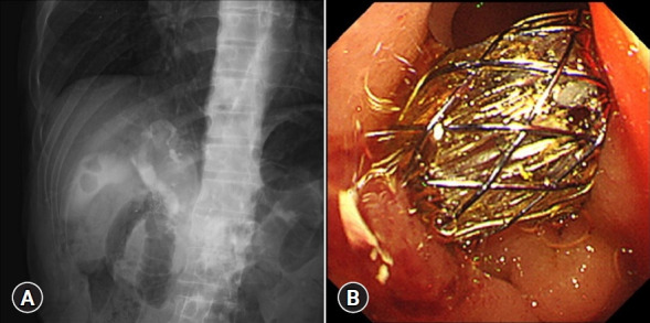 Fig. 3.