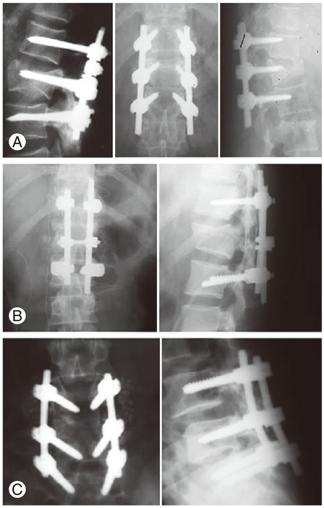 Fig. 11