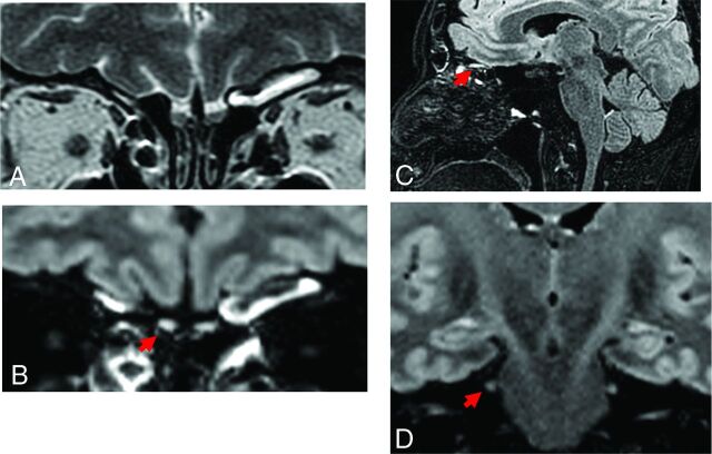 FIG 3.