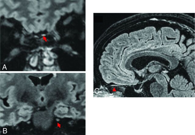 FIG 4.