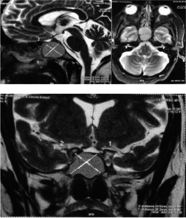Fig. 3