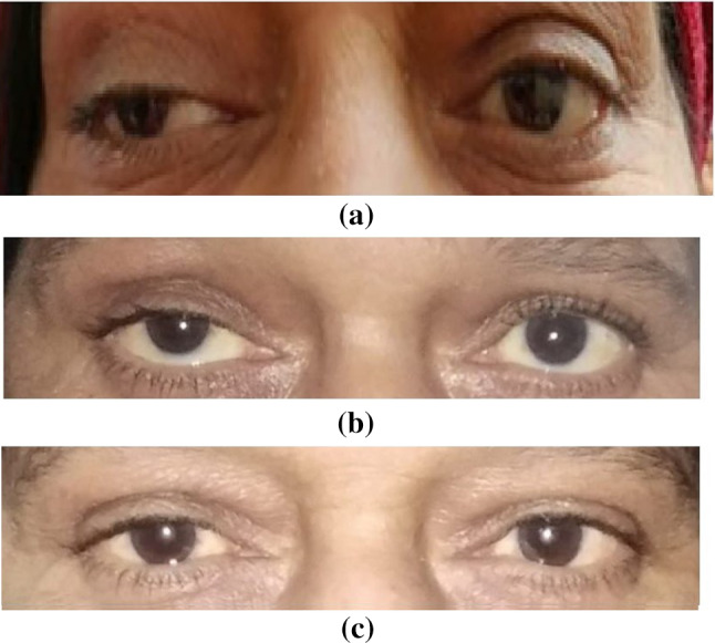 Fig. 2