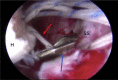 Fig 14