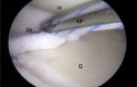 Fig 11