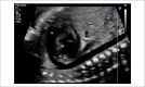 Figure 2.4