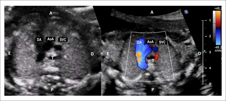 Figure 2.2