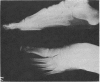 112