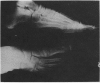 112