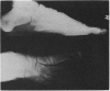 111