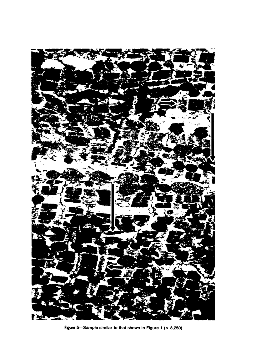 95