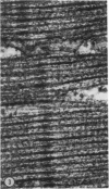 93