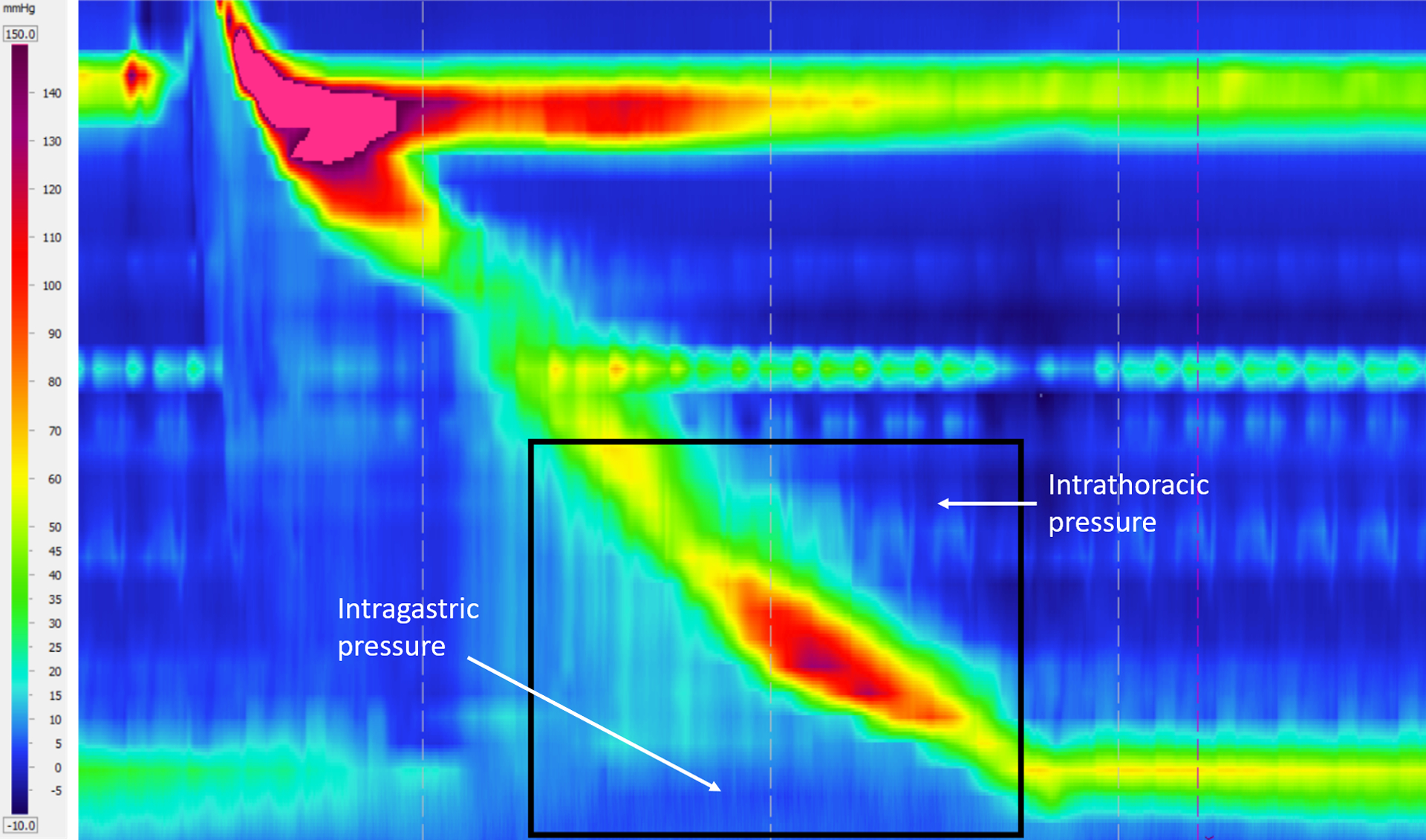 Figure 4: