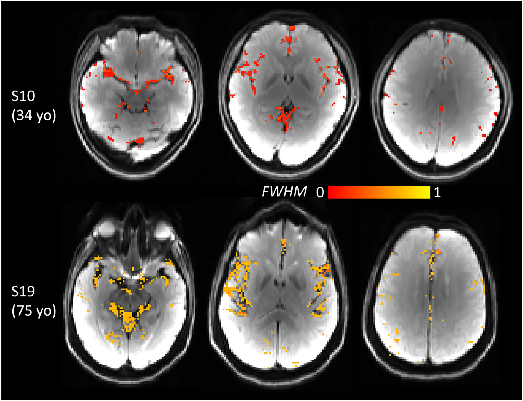 Fig. 12.