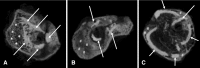 Fig. 4A–C
