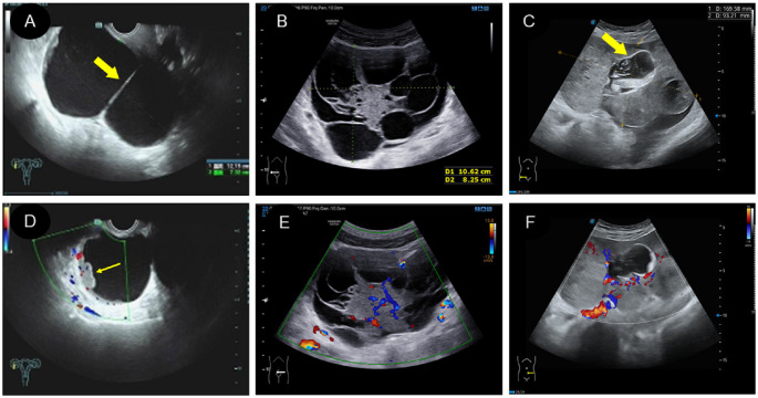 Figure 3