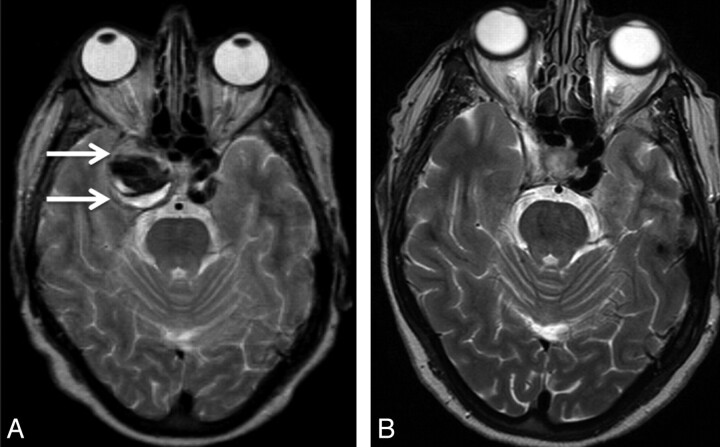 Fig 2.