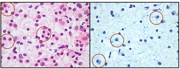 [Table/Fig-4]: