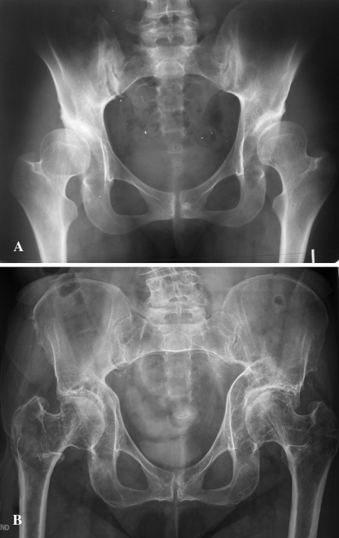 Fig. 4A–B