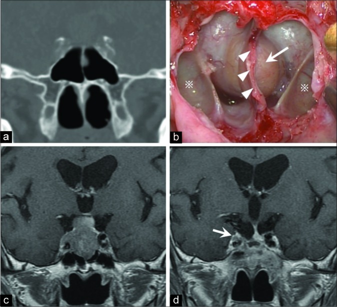 Figure 2: