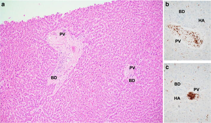 Fig. 12