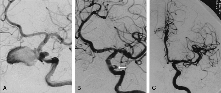 Fig 3.