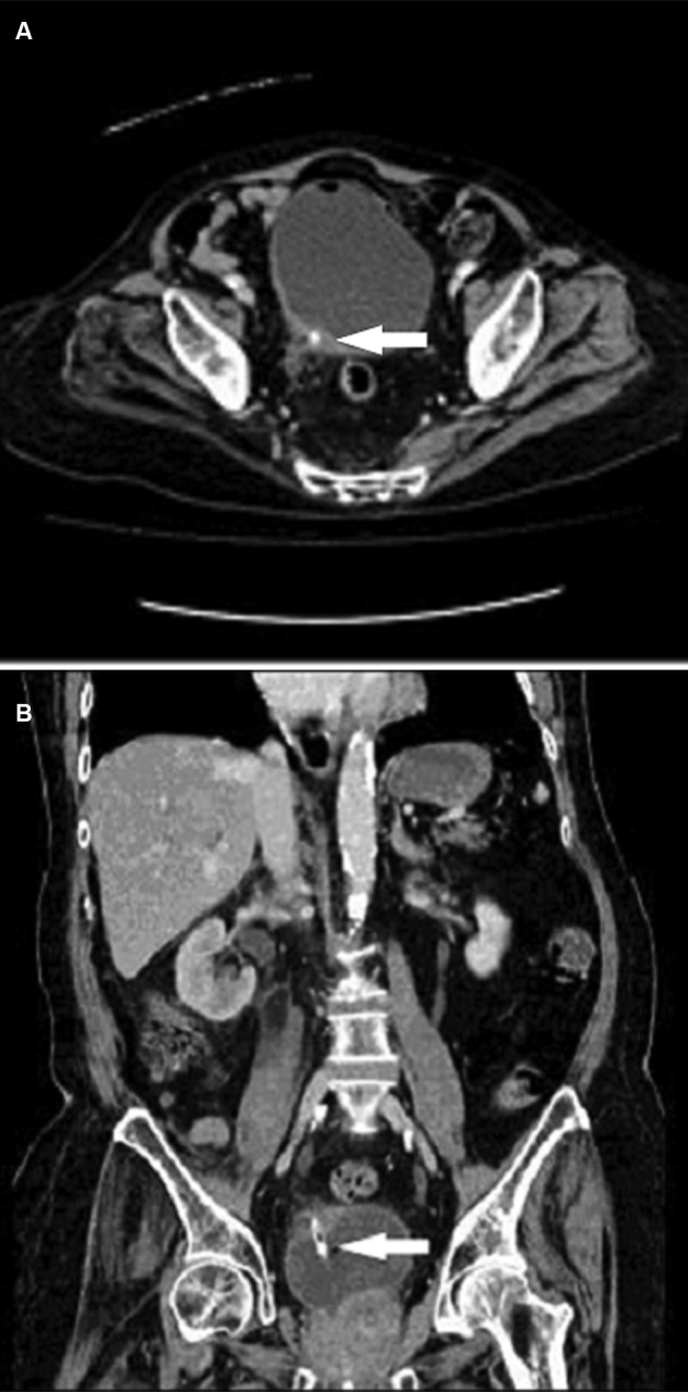 Figure 1