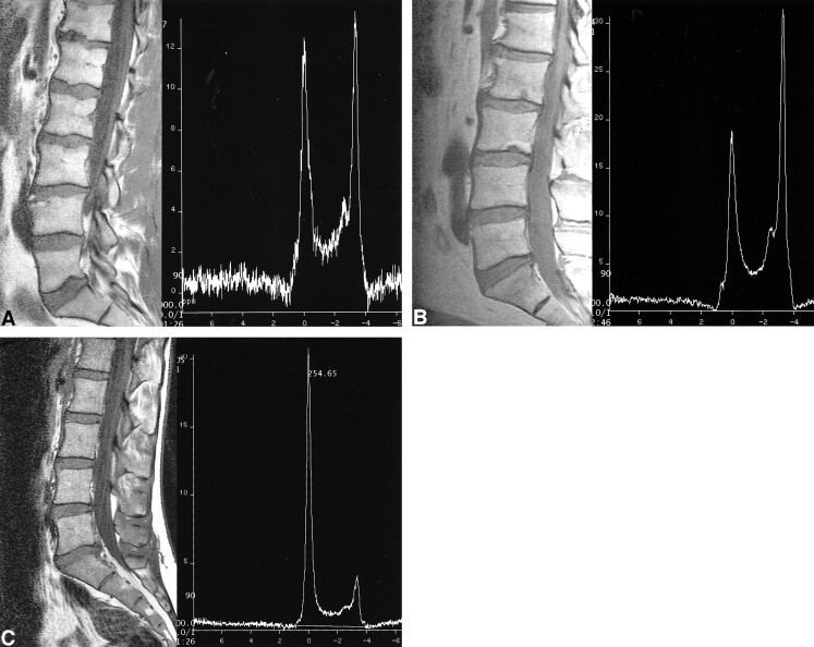 fig 3.