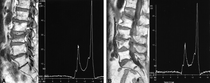 fig 4.