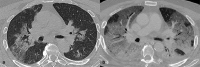 Figure 12.