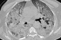 Figure 11.
