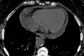 Figure 14.
