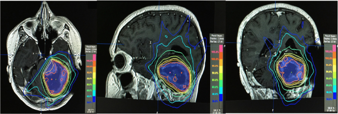 Fig. 7