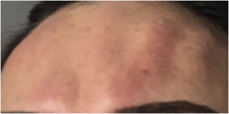Fig. 4