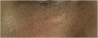 Fig. 10