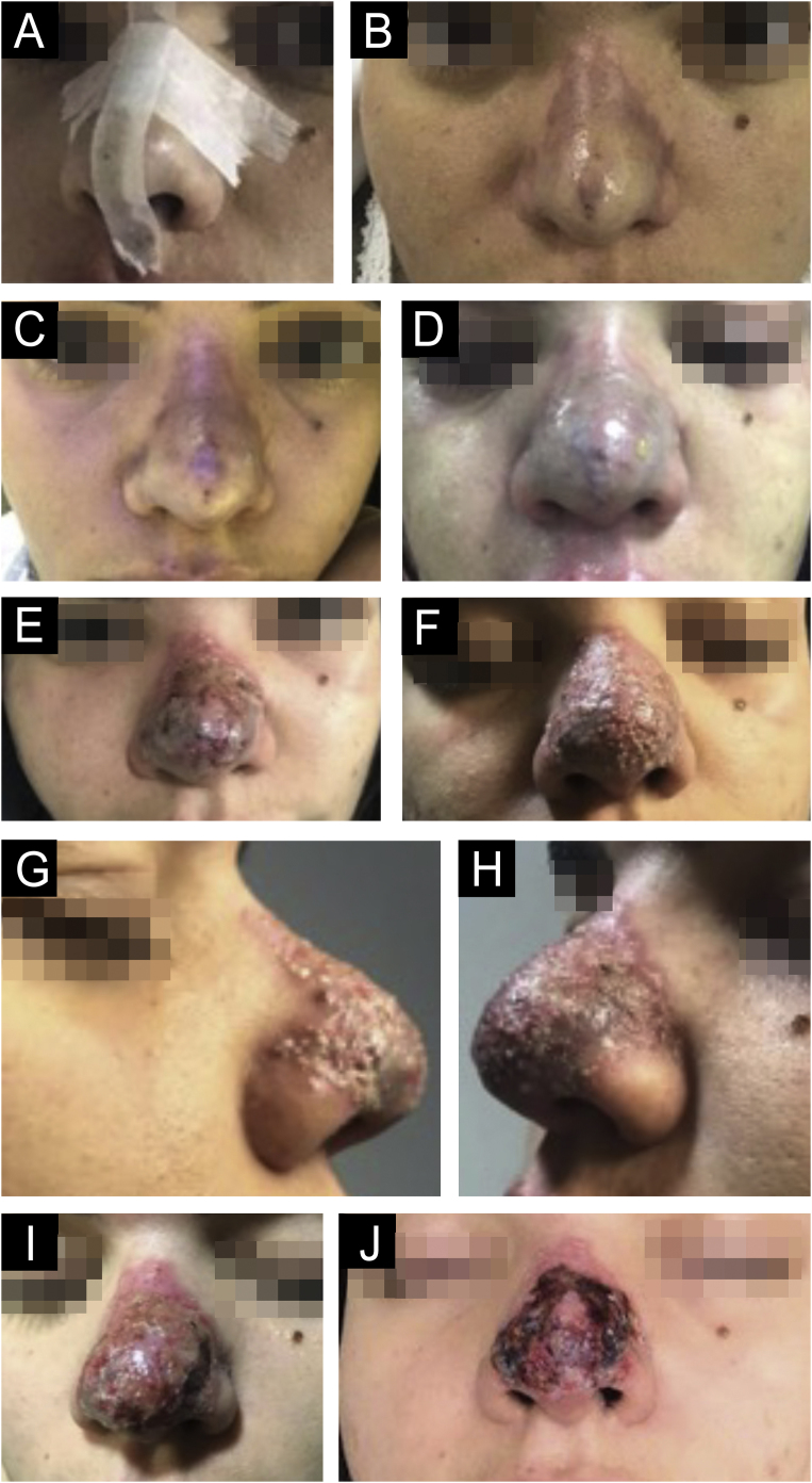 Fig. 11