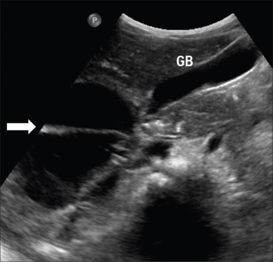 Figure 14